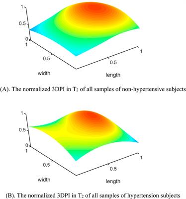 Corrigendum: Increasing the sensor channels: a solution for the pressing offsets that cause the physiological parameter inaccuracy in radial artery pulse signal acquisition